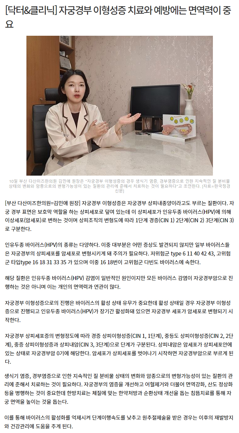이형성 정경 뉴스