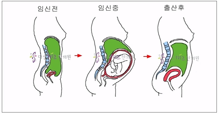 교정 둘