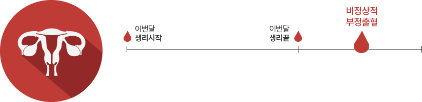 이번달 생리시작 이번달 생리끝 비정상적 부정출혈