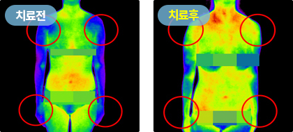 치료전 치료후