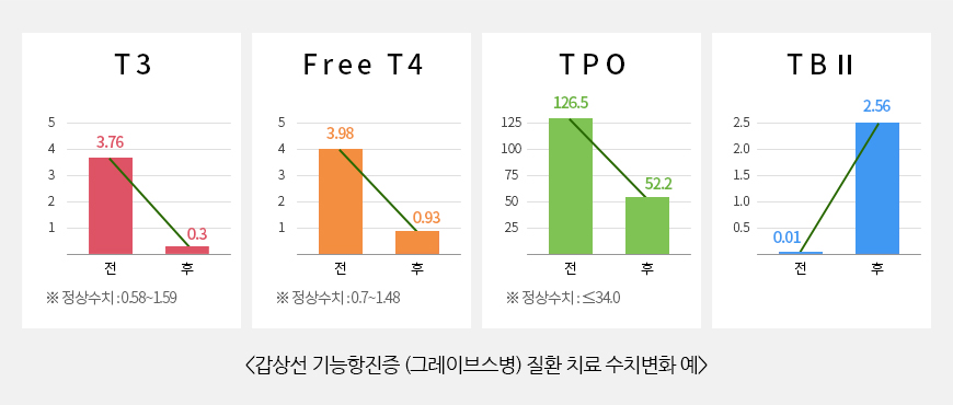 갑상선 기능항진증 (그레이브스병) 질환 치료 수치변화 예